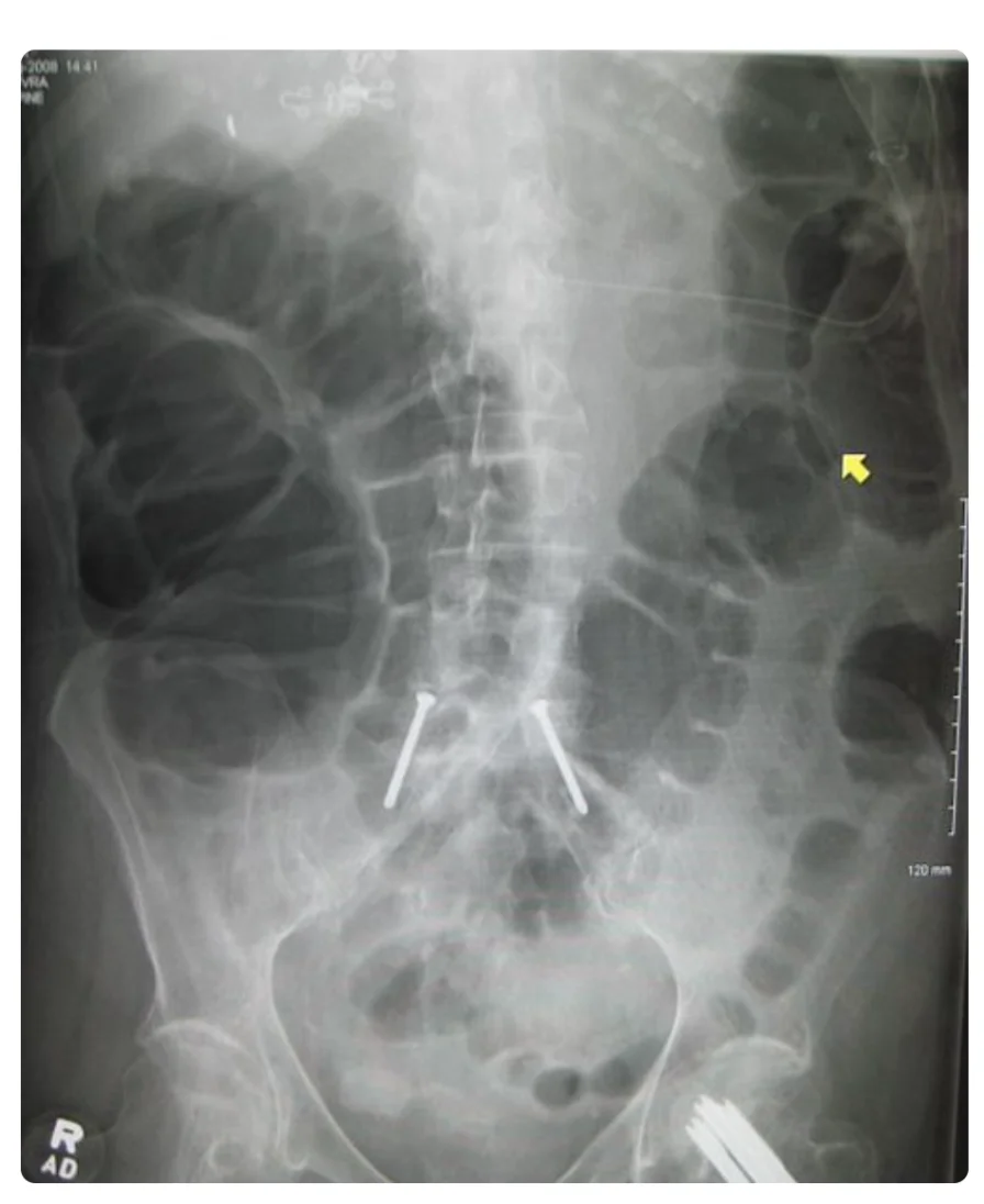 Annotated abdominal X-ray for OSCE AI data interpretation